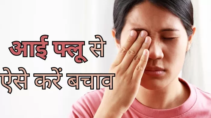 आई फ्लू से बचाव के लिए अपनाएं ये टिप्स