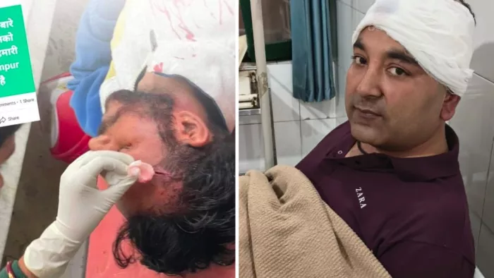 विधानसभा क्षेत्र गगरेट में देर रात भाजपा और कांग्रेस समर्थकों में खूनी झड़प हो गई।