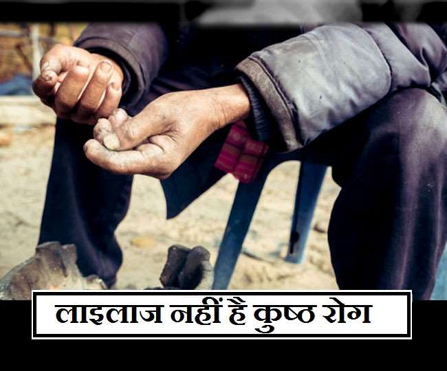 Leprosy Treatment