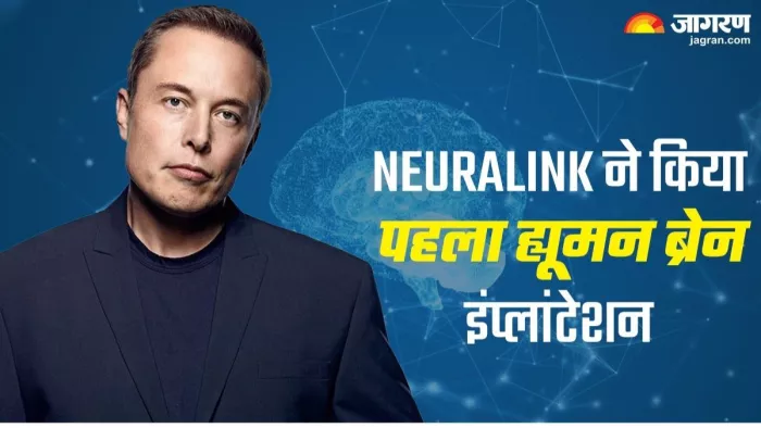 Neuralink ने अपने पहले मरीज के दिमाग में लगाया चिप, यहां जानें डिटेल