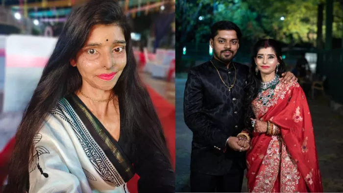 छपाक फिल्म में काम कर चुकी हैं रितु शर्मा