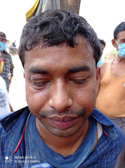 पीएम आवास के नाम पर ठगनेवालों की धुनाई कर किया पुलिस के हवाले