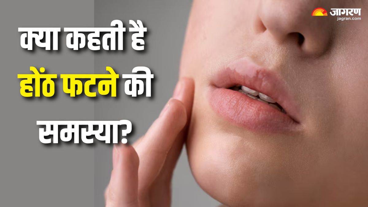 https://www.jagranimages.com/images/newimg/30042025/30_04_2025-cracked_lips_23927833.jpg