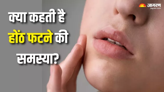 किन वजहों से बार-बार फटने लगते हैं होंठ? (Picture Courtesy: Freepik)