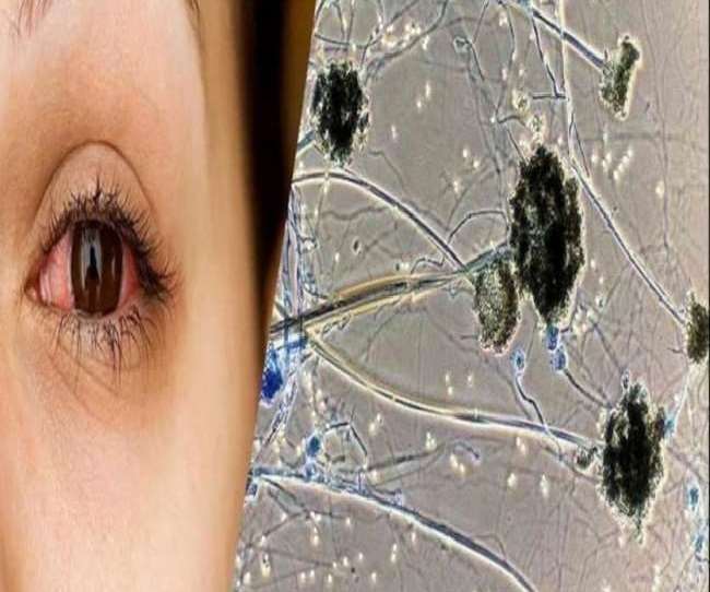 कई मरीजों ने कोरोना की किसी भी तरह की कोई जांच ही नहीं कराई