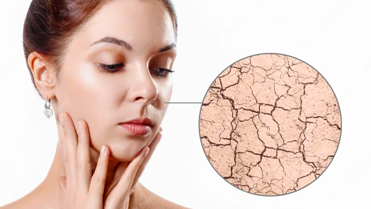https://www.jagranimages.com/images/newimg/30052023/30_05_2023-face_packs_for_dry_skin_f_23427778.jpg