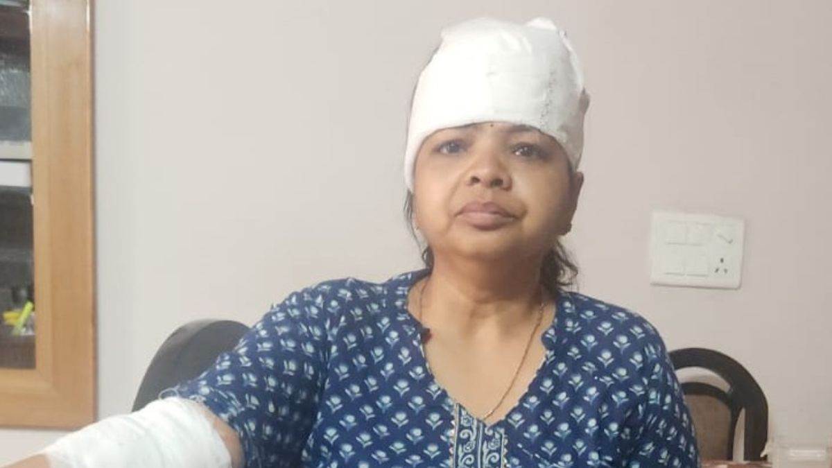 stray dog attack woman injured in hapur city park