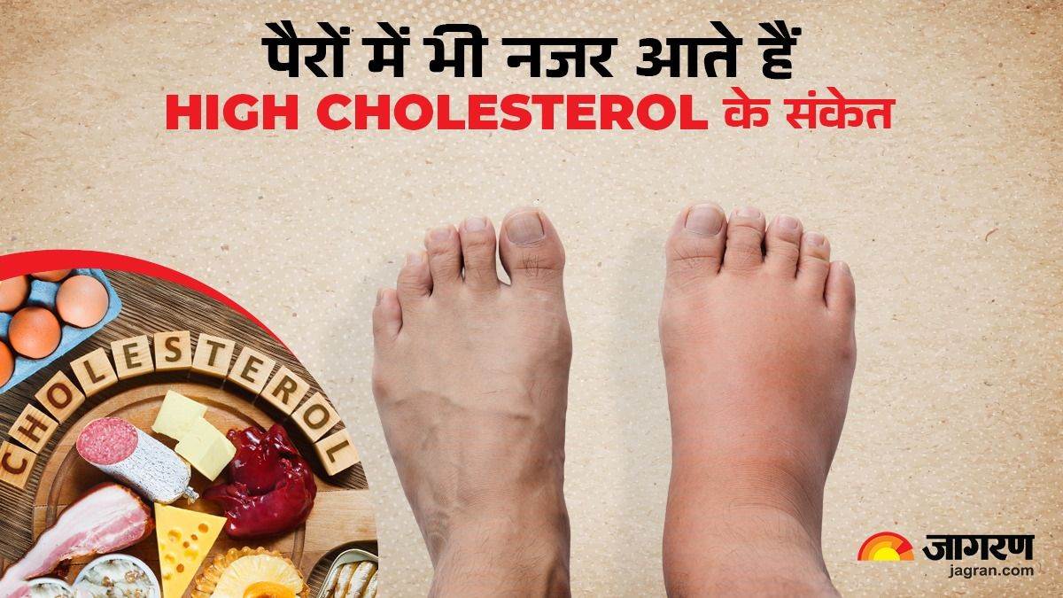https://www.jagranimages.com/images/newimg/30052025/30_05_2025-high_cholesterol_23951016.jpg