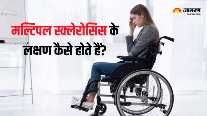 World MS Day: क्या मल्टिपल स्क्लेरोसिस का कोई इलाज है? (Picture Courtesy: Freepik)