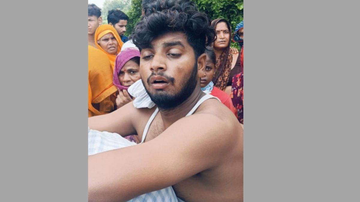 https://www.jagranimages.com/images/newimg/30062025/30_06_2025-firozabad_youth_snake_bite_23971065.jpg