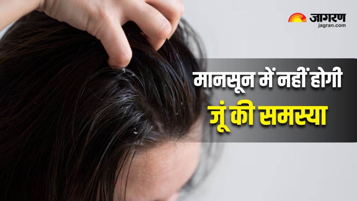 https://www.jagranimages.com/images/newimg/30062025/30_06_2025-lice_and_nits_home_remedies_23971649.jpg