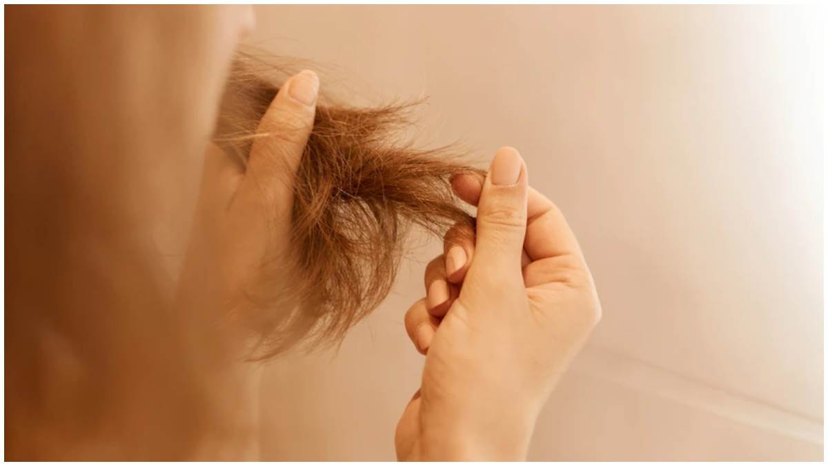 Details 82+ vitamin b12 and hair loss best in.eteachers