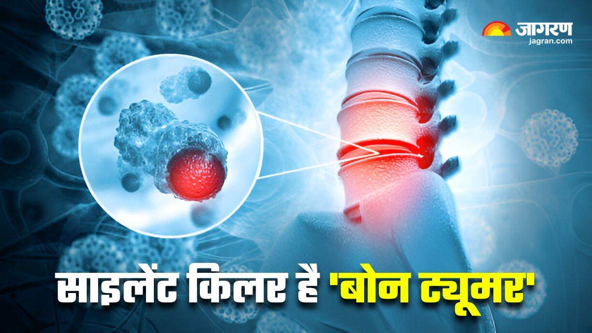 https://www.jagranimages.com/images/newimg/30072025/30_07_2025-bone_tumors_23998586.jpg