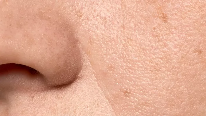 Skin Care Tips: ओपन पोर्स को इन घरेलू उपायों से करें ठीक