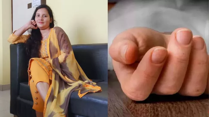 दहेज का शिकार हुई मासूम रुचि की फाइल फोटो।