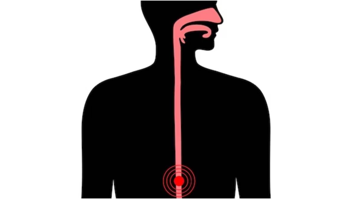 https://www.jagranimages.com/images/newimg/31012023/31_01_2023-esophageal_cancer_23314961.jpg