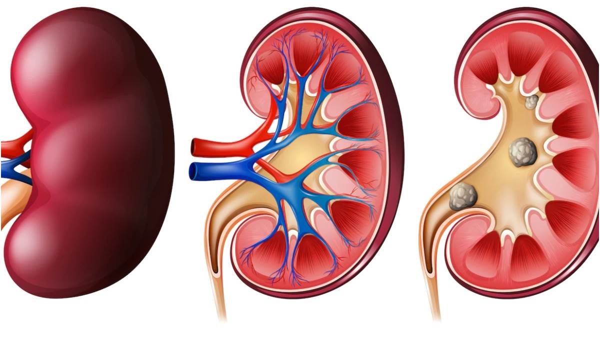 https://www.jagranimages.com/images/newimg/31012023/31_01_2023-kidney_health_23314912.jpg