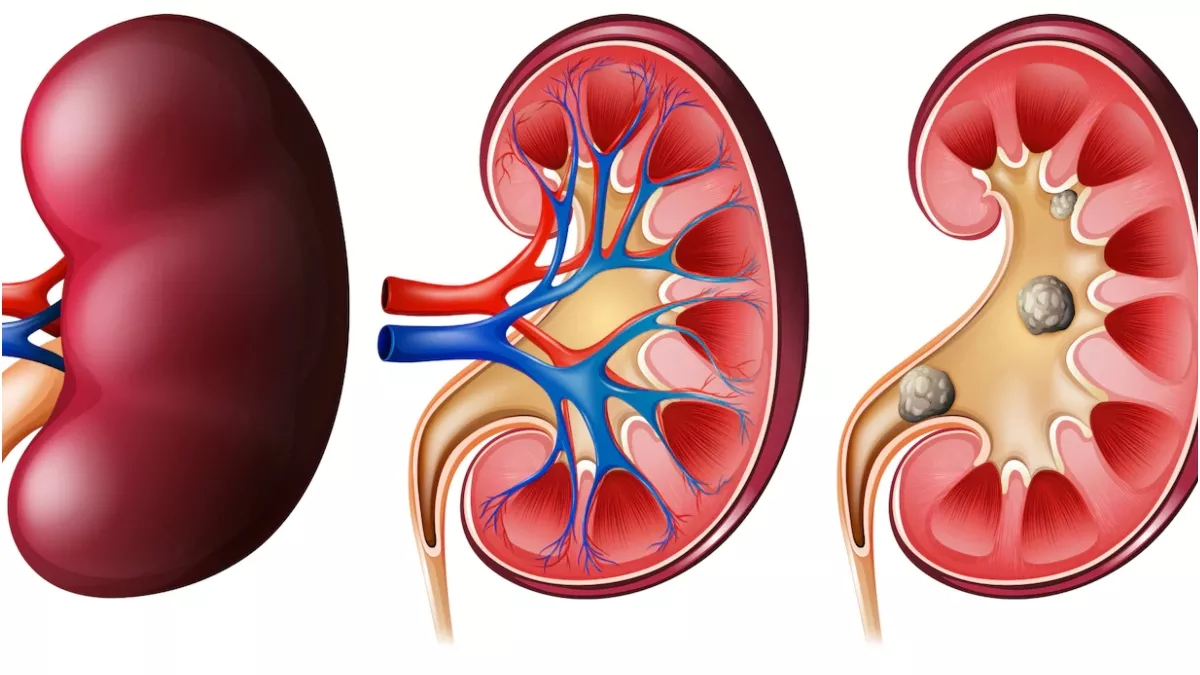 Kidney Health: कमजोर किडनी की समस्या को ना करें अनदेखा, अपनाएं यह घरेलू उपाय