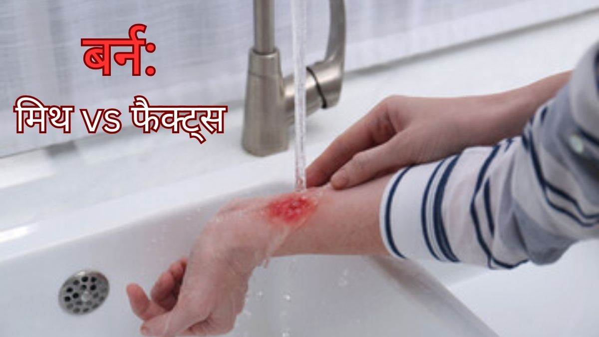https://www.jagranimages.com/images/newimg/31012024/31_01_2024-burn_23642422.jpg