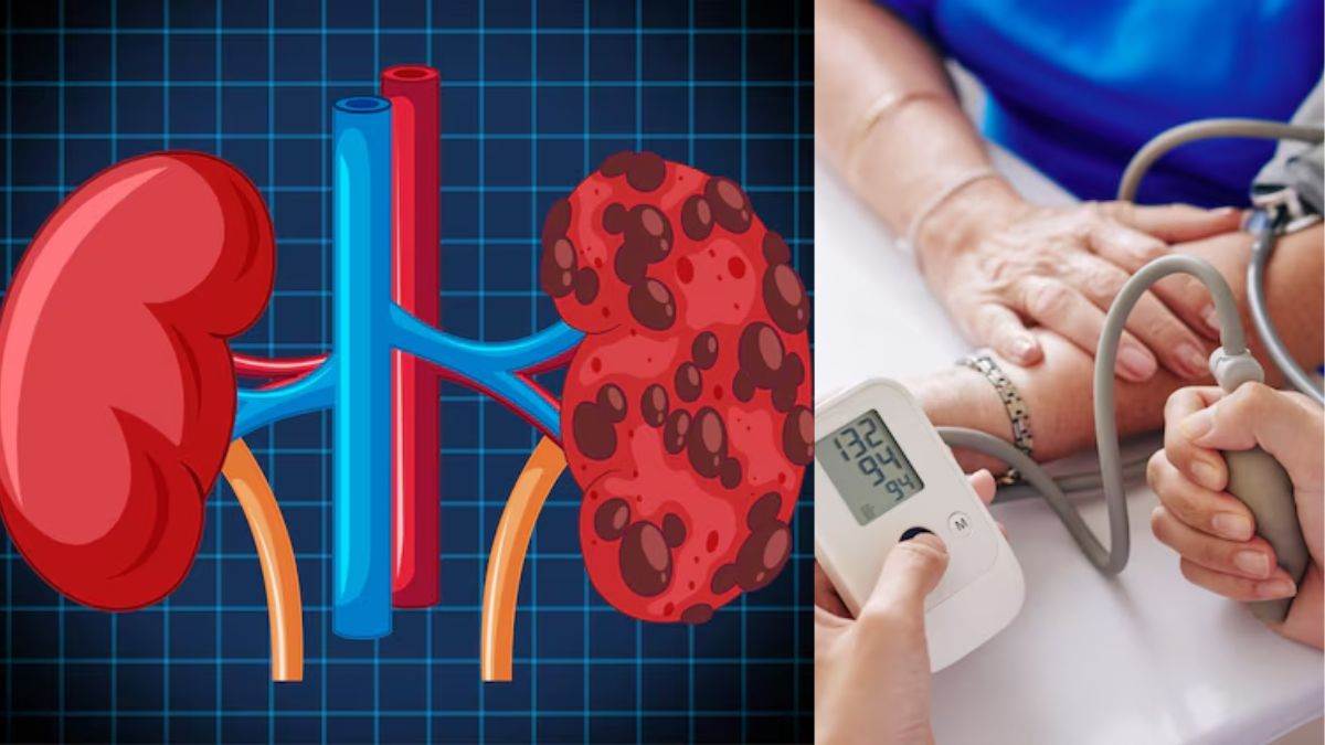 https://www.jagranimages.com/images/newimg/31032025/31_03_2025-kidney_and_high_blood_pressure_23909125.jpg