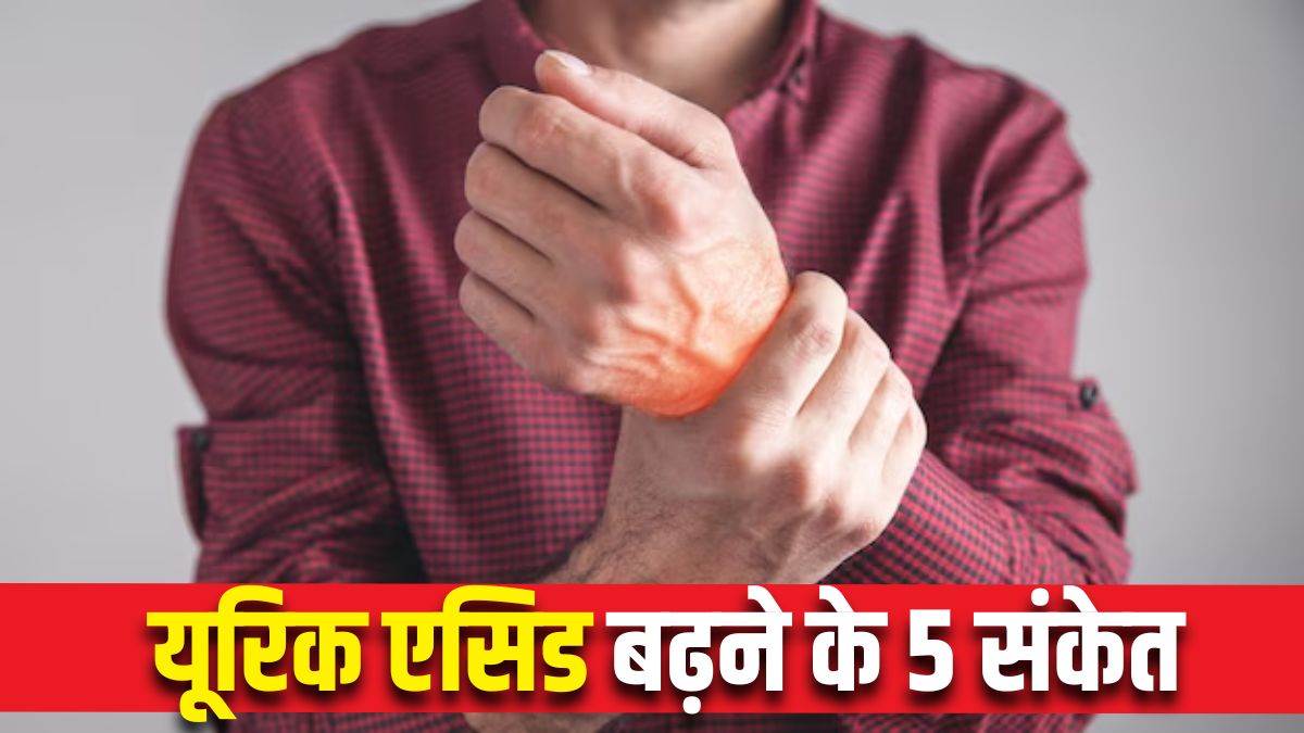 https://www.jagranimages.com/images/newimg/31032025/31_03_2025-uric_acid_symptoms_in_urine_23909179.jpg
