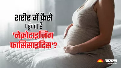 https://www.jagranimages.com/images/newimg/31052023/31_05_2023-flesh-eating-bacteria_23428305_162910430.jpeg