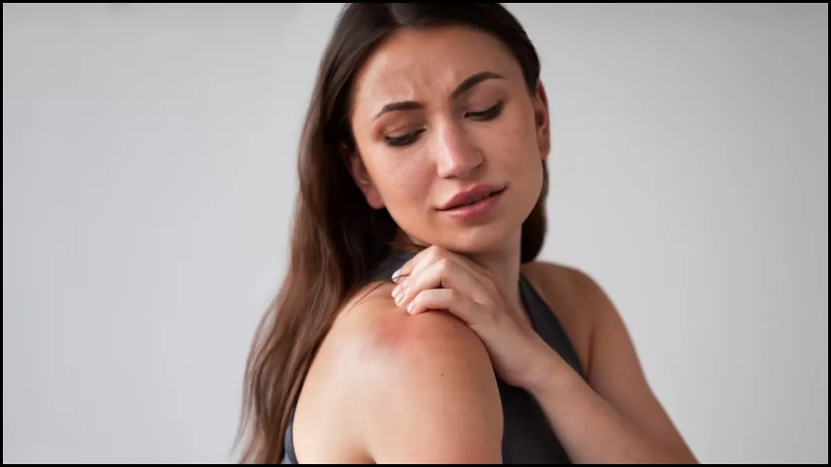 Prickly Heat गर्मियों में घमौरियों ने कर रखा है परेशान तो इन 5 घरेलू उपायों  से पाएं जल्द आराम - Five Effective Home Remedies for Prickly Heat ghamori  ke liye gharelu nuskhen