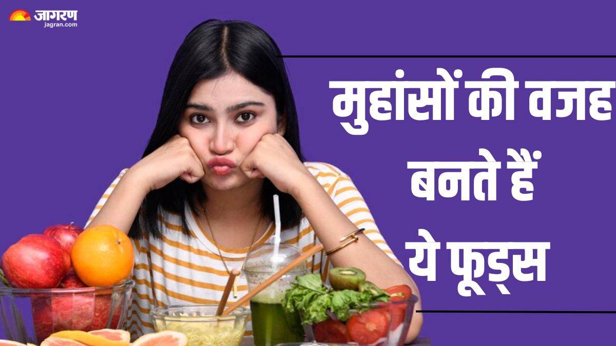 https://www.jagranimages.com/images/newimg/31052024/31_05_2024-acne_causing_foods_23728875_112352966.jpg