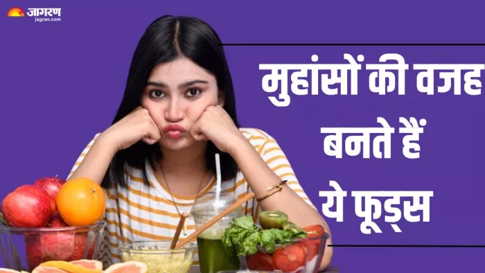 ये फूड आइटम्स बनते हैं मुहांसों की वजह (Picture Credit- Freepik)