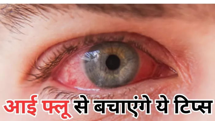 आई फ्लू से बचाव के लिए रखें इन बातों का ध्यान