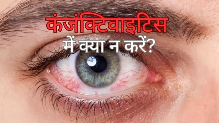 इन दिनों कंजक्टिवाइटिस से बचना है तो क्या करें?