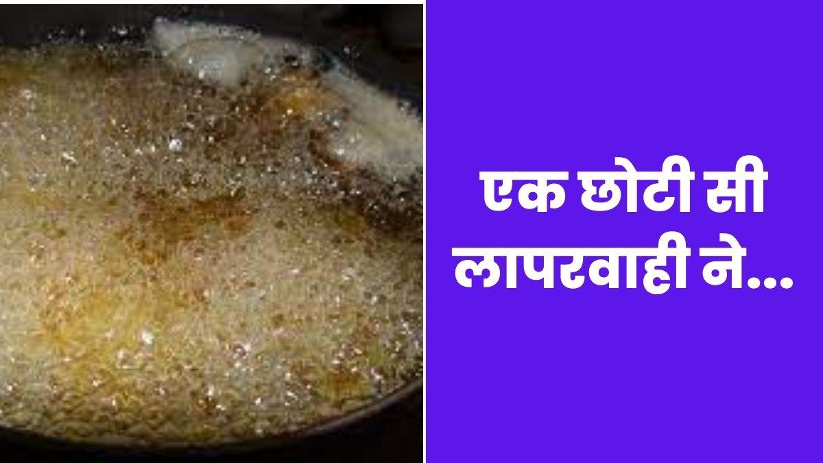 Pilibhit मां तेल में तल रही थी पूड़‍ियां; तीन साल का बेटा उसी खौलती