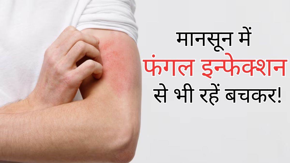 https://www.jagranimages.com/images/newimg/31072023/31_07_2023-monsoon-fungal-infection_23487591.jpg