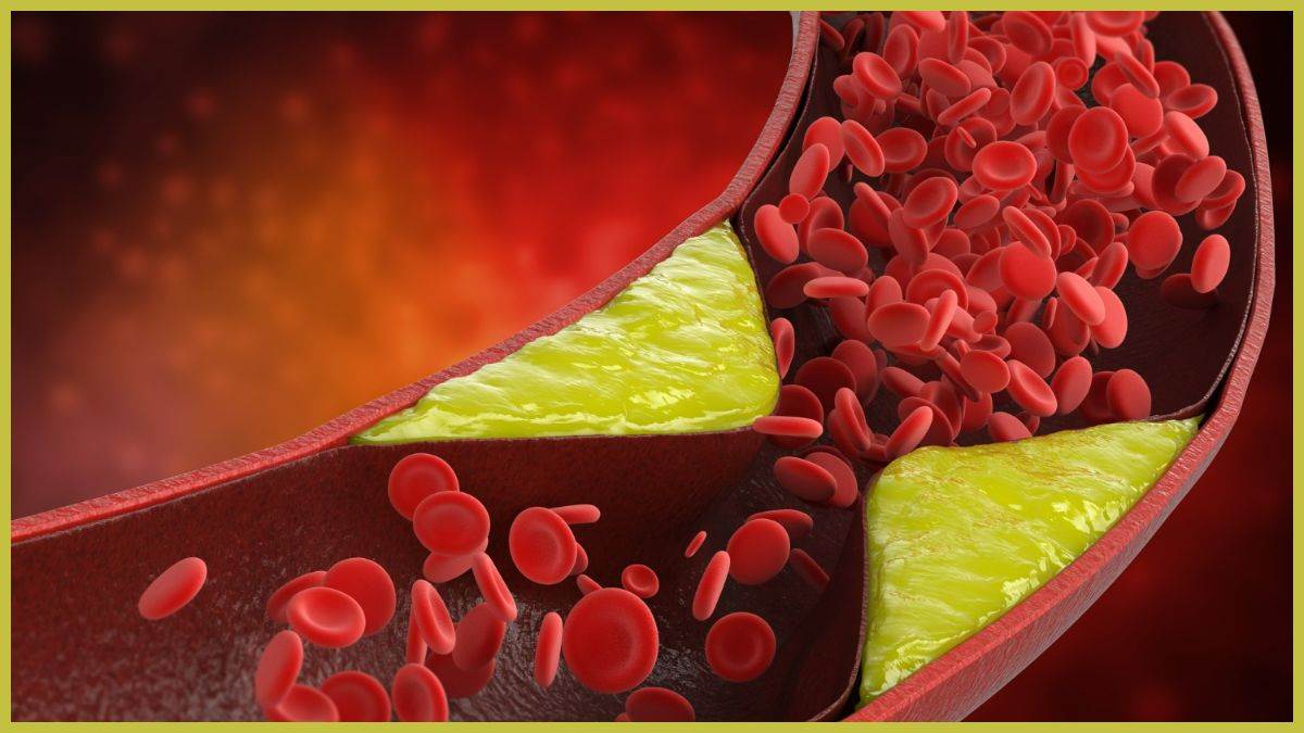 https://www.jagranimages.com/images/newimg/31072025/31_07_2025-bad_cholesterol_23999482.jpg