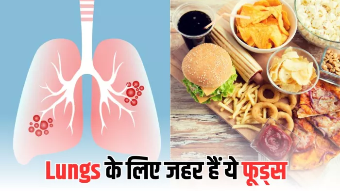 World Lung Cancer Day 2025: खानपान की आदतों पर दें ध्यान (Image Credit- Freepik)