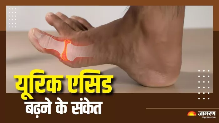 यूरिक एसिड बढ़ने के लक्षण कैसे होते हैं? (Picture Courtesy: Freepik)