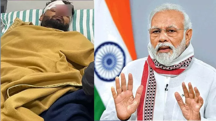 Rishabh Pant Accident: पंत के उपचार पर नजर रख रहे PM मोदी