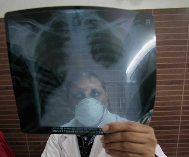 Image result for tuberculosis jagran Special