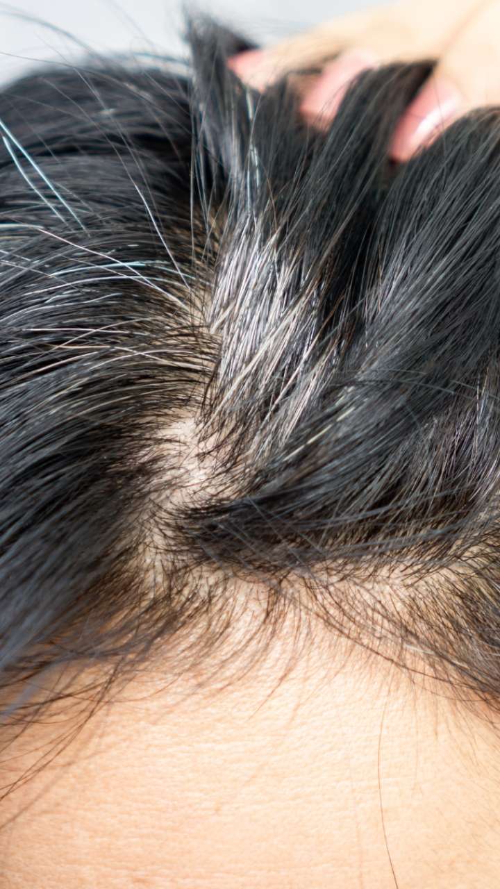 बालों को नेचुरली काला बनाने के लिए आजमाएं ये नुस्खे