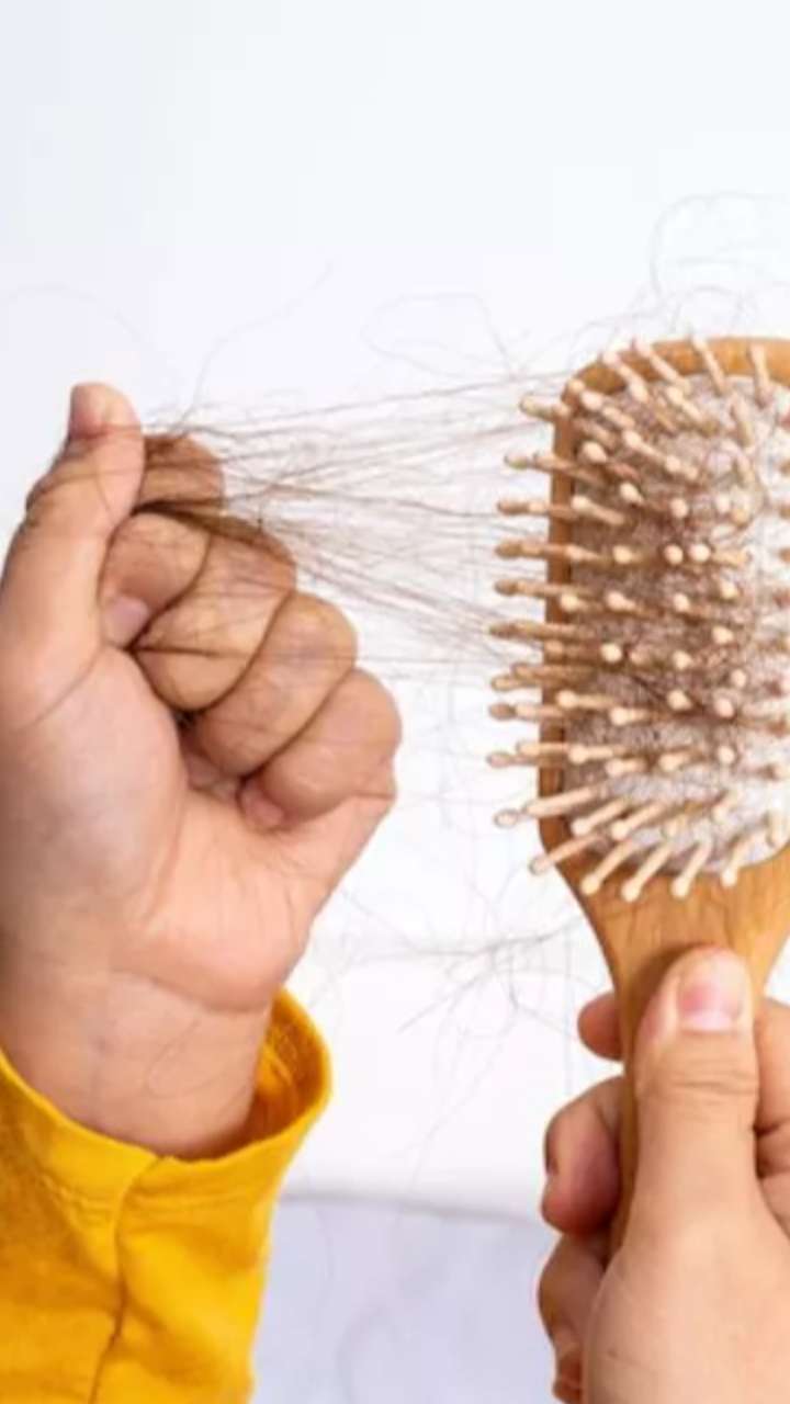 झड़ते बालों को रोकने वाले जबरदस्त उपाय