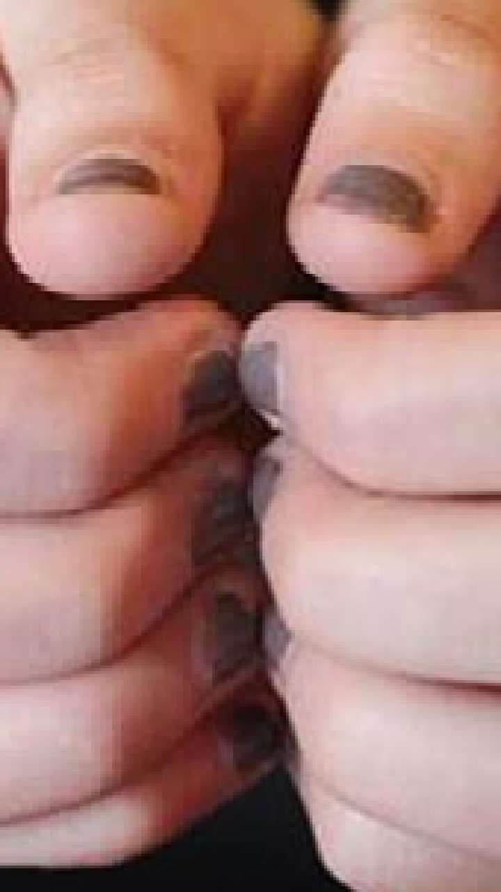 नाखून रगड़ने के फायदे, रोज 10 मिनट तक रगड़ें, दिखने लगेगा चेंज | benefits  of rubbing nails | Patrika News